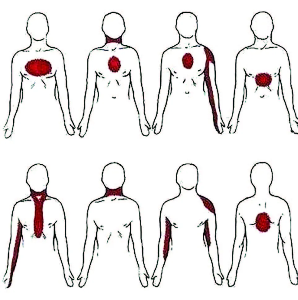 Why Do Young, Fit People Have Heart Attacks? A Cardiologist Explains